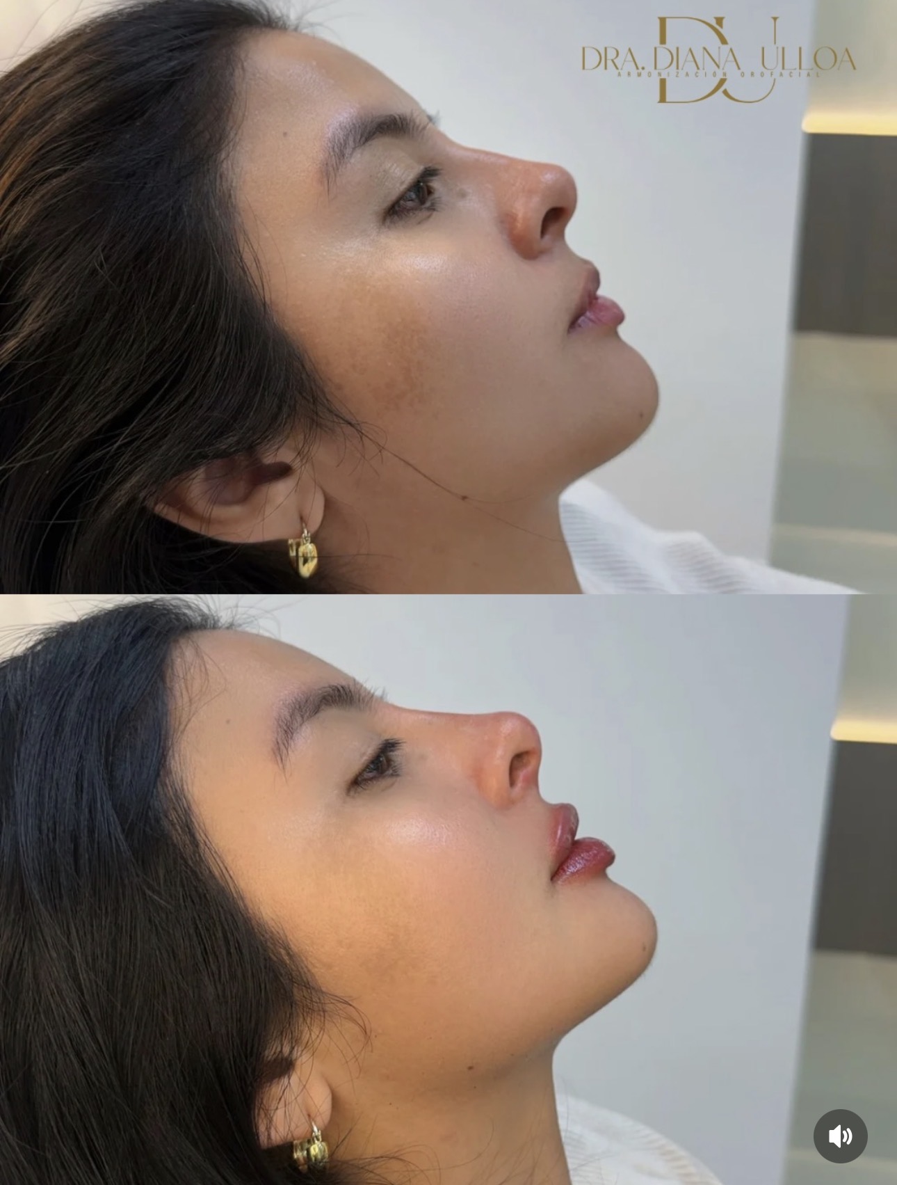 Volumen y estructura